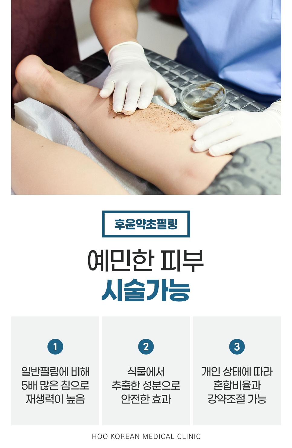 후윤약초필링 예민한 피부도 시술 가능한 이유 3가지