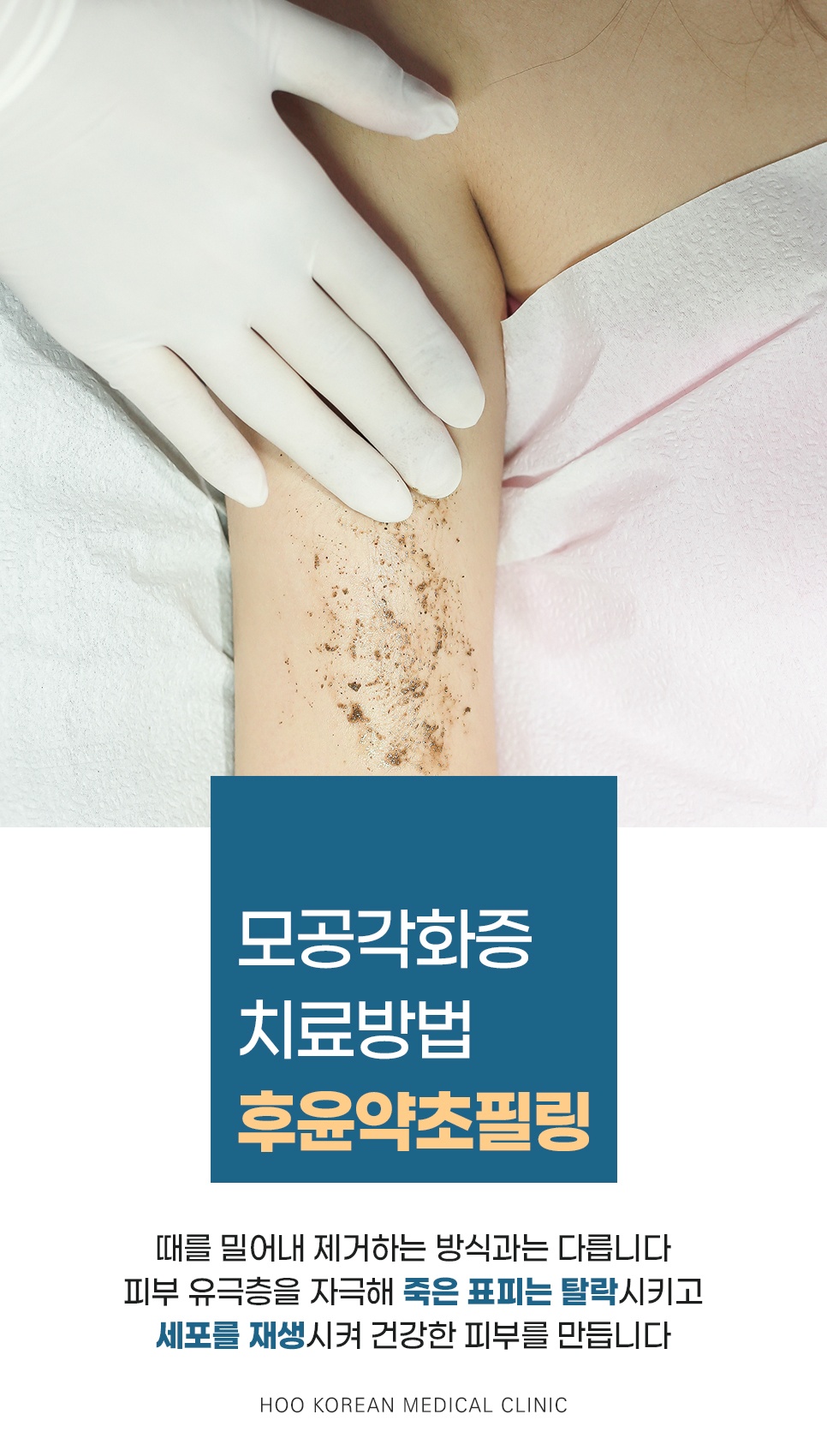 후윤약초필링 시술 장면, 죽은 표피 탈락과 세포 재생 원리 설명