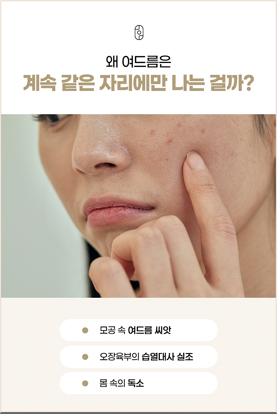 같은 자리에만 여드름이 반복되는 원인