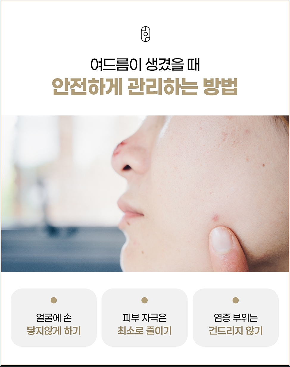 여드름을 안전하게 관리하는 일상 습관