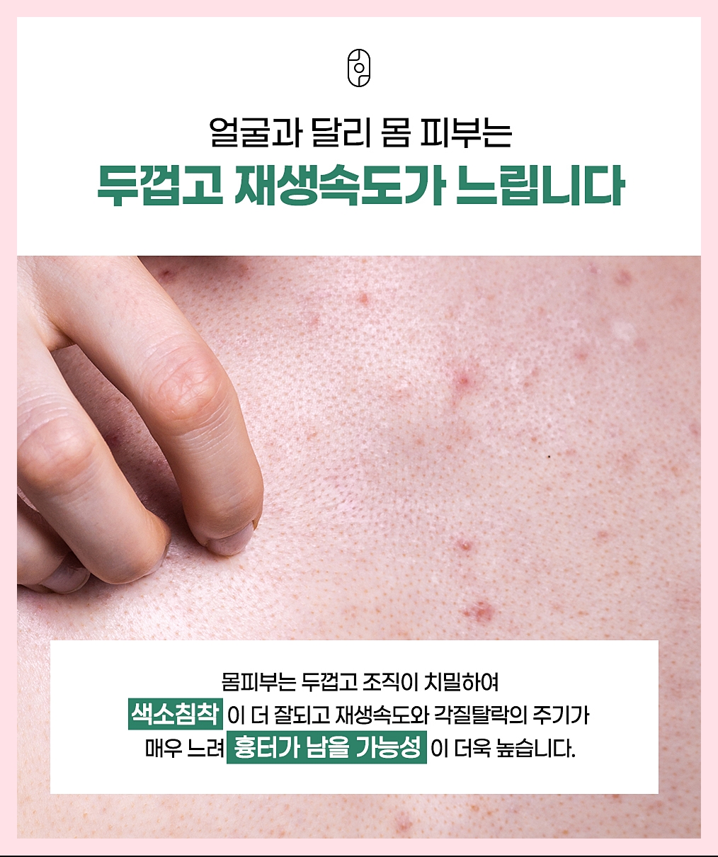 등드름을 악화시키는 요인을 정리한 안내 이미지