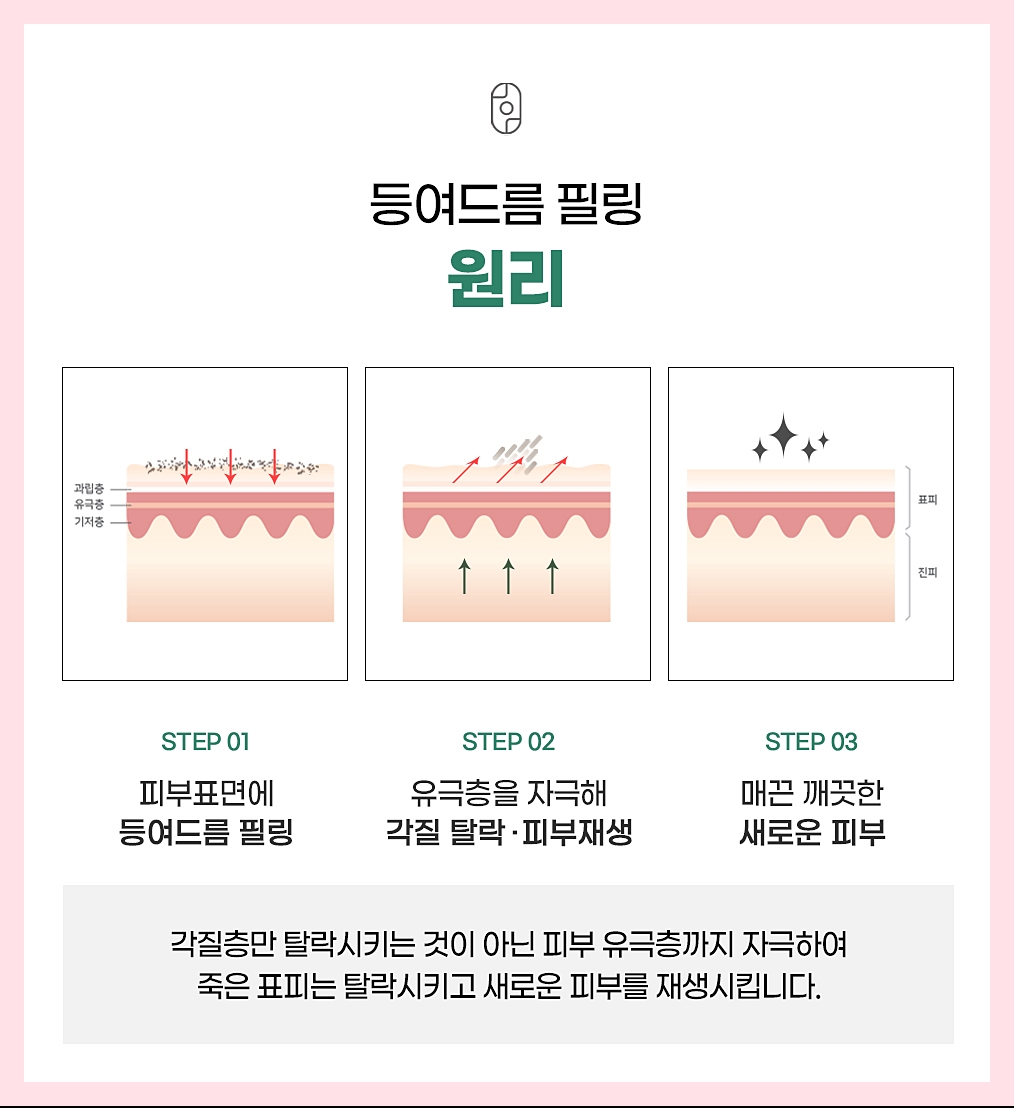 후윤약초필링으로 등여드름을 관리하는 원리 요약 이미지