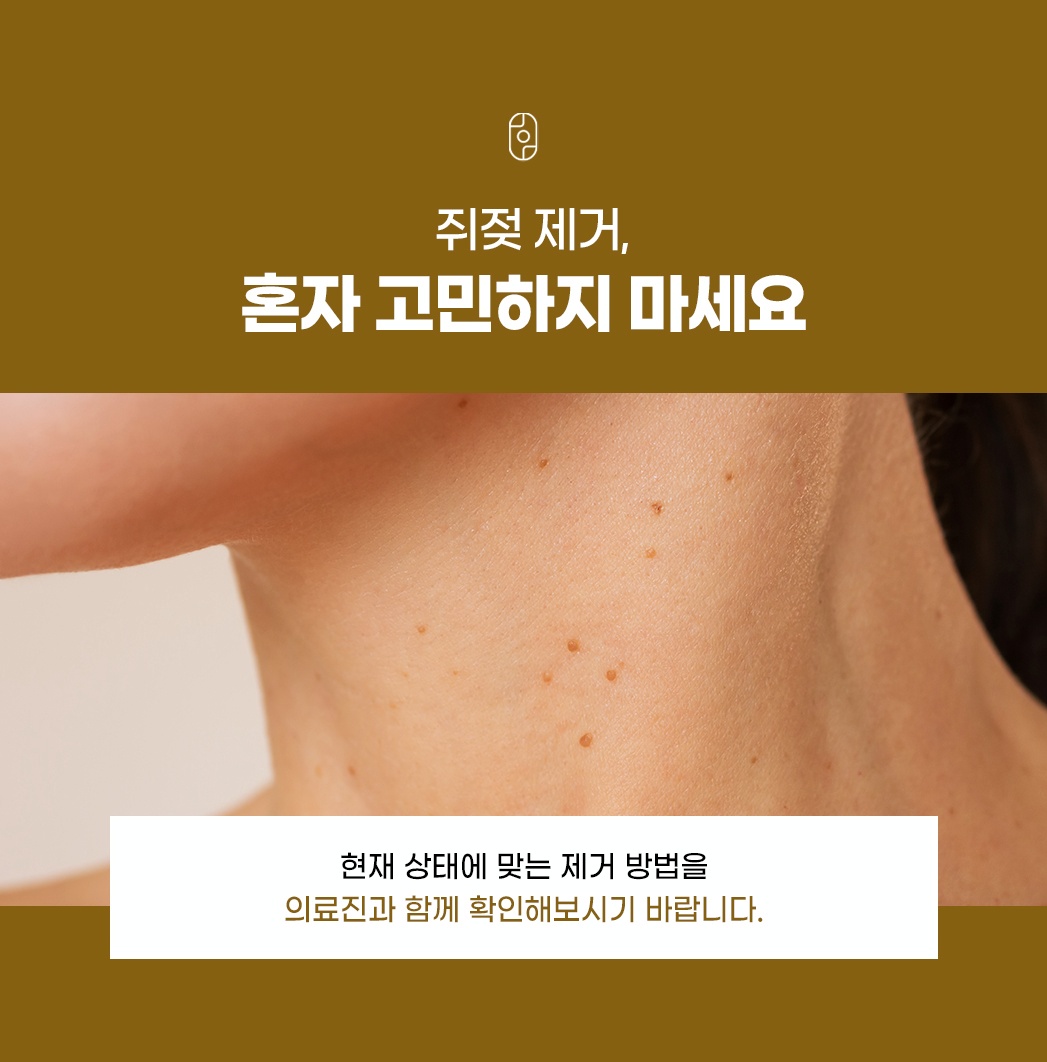 목 부위 쥐젖 피부 상태 맞춤 제거 치료 안내
