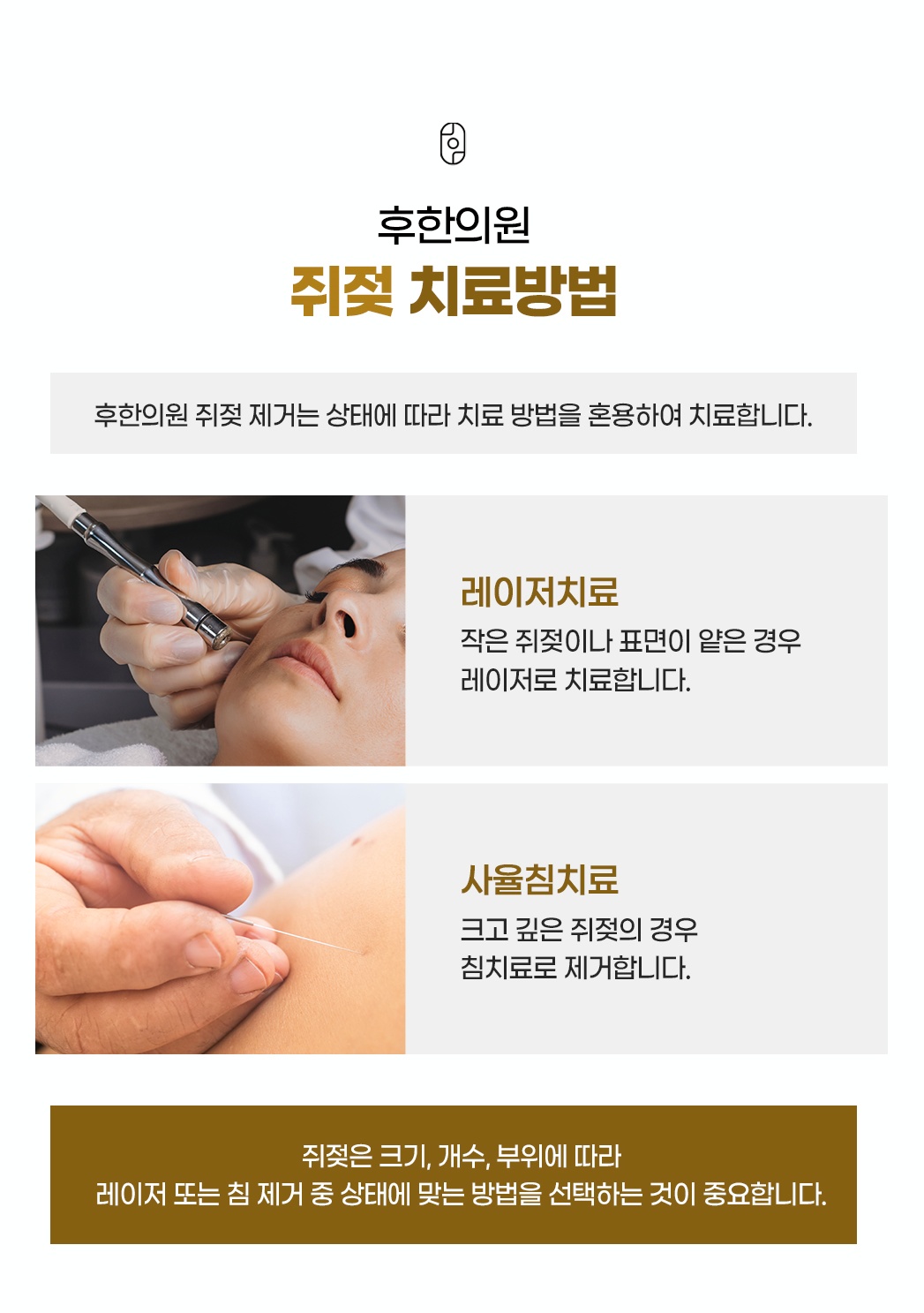 후한의원 맞춤 쥐젖 치료 방법 (레이저치료 및 사율침치료)