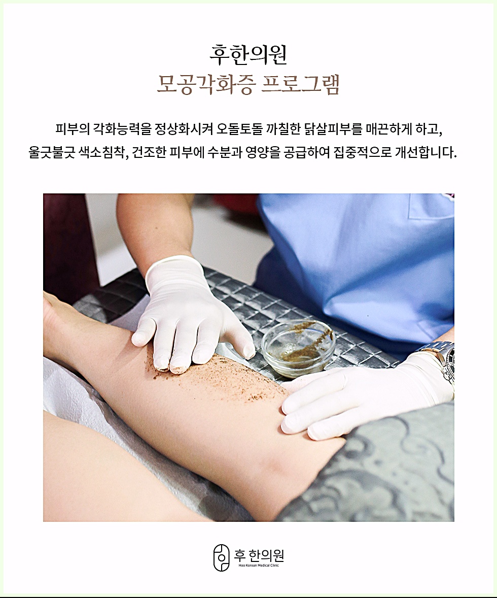 천안모공각화증치료 후윤약초필링 진행 모습