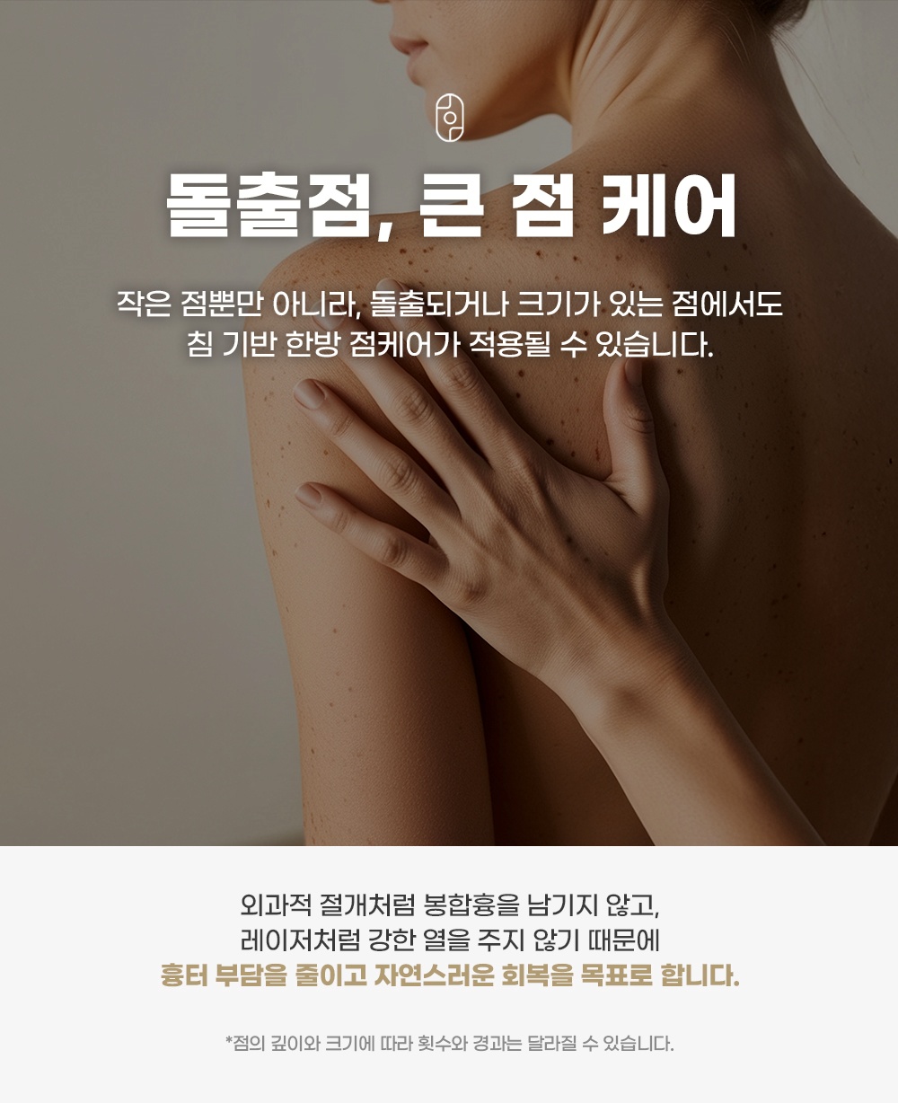 봉합흉터와 레이저 열 자극 부담을 줄이는 돌출점 및 큰 점 침 치료 케어