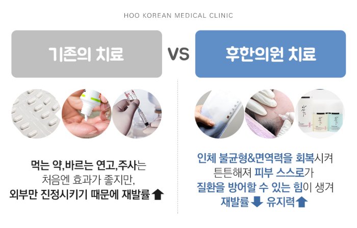 기존 지루성피부염 치료와 후한의원 치료 방식 비교 안내