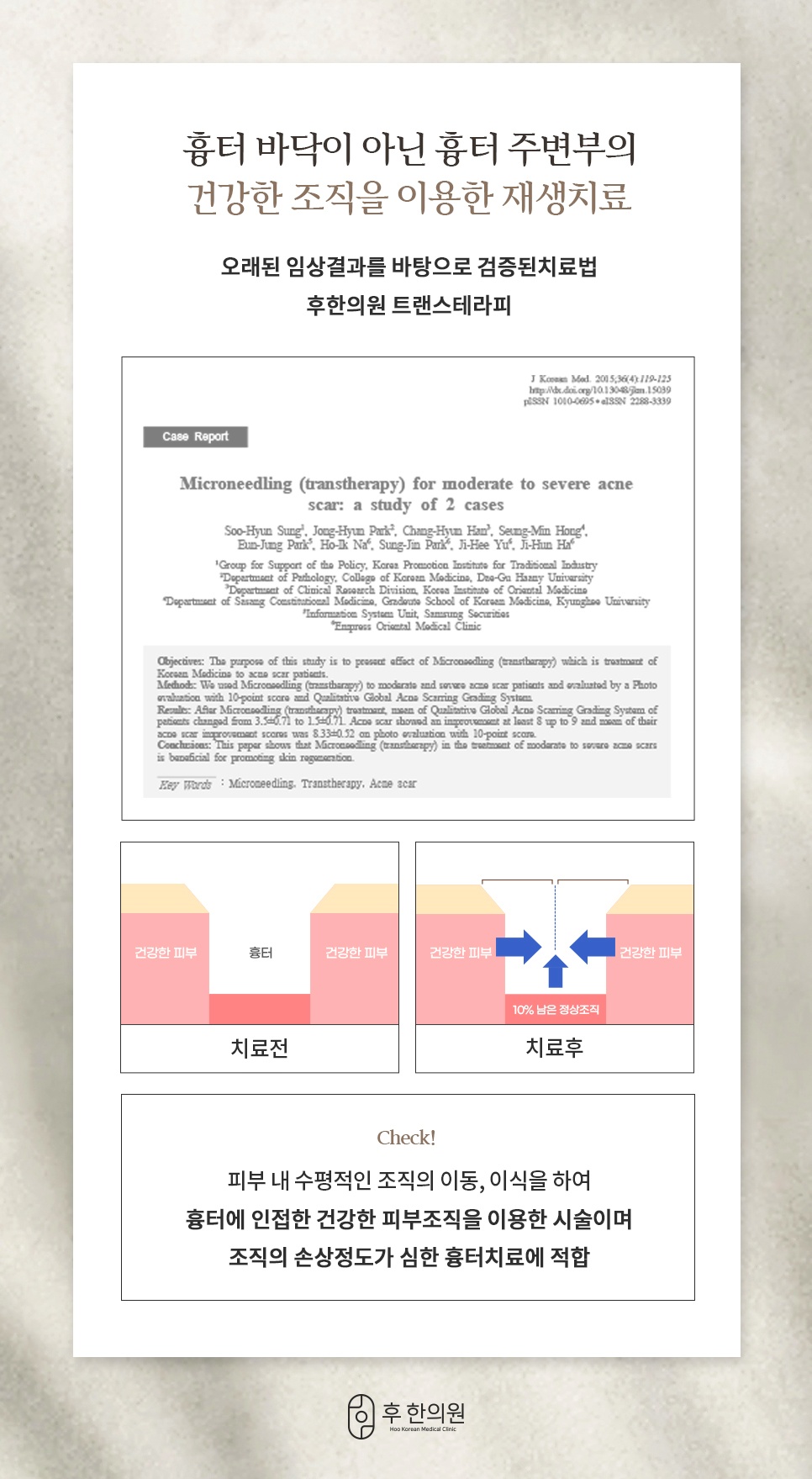 흉터 바닥이 아니라 주변 건강한 조직을 이동시켜 재생하는 트랜스테라피 논문과 치료 전후 단면도
