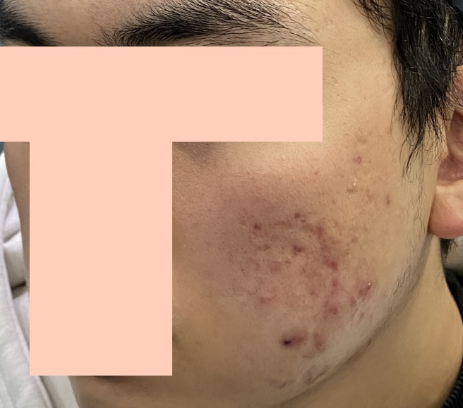 Before