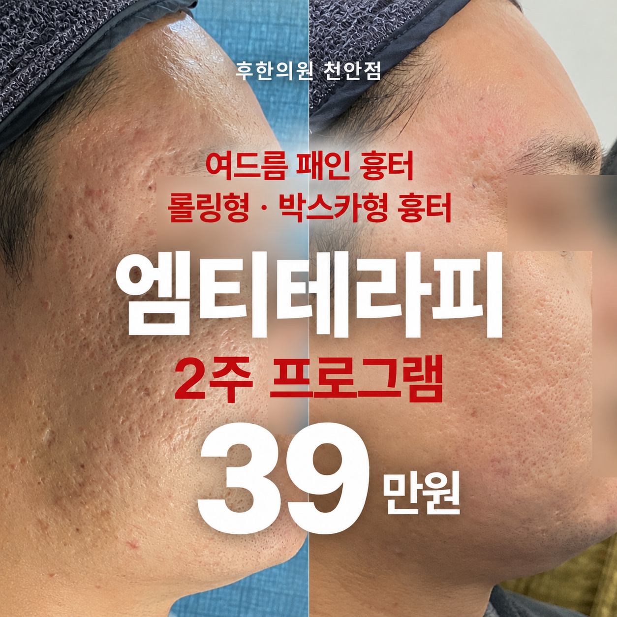 썸네일이미지