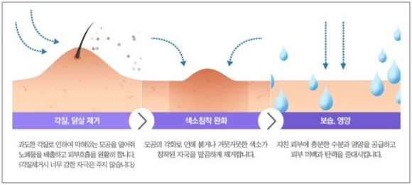 천안 모공각화증 치료