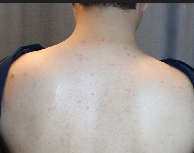 천안 등드름 1월 22일